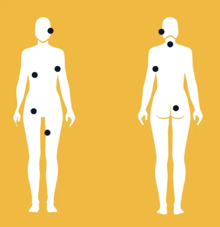 HS oireiden sijainteja